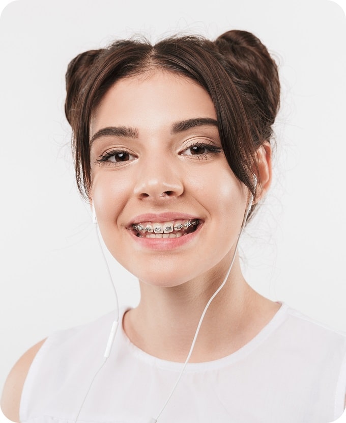 Dental Braces