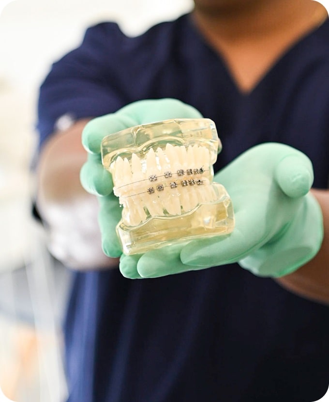 Dental Braces