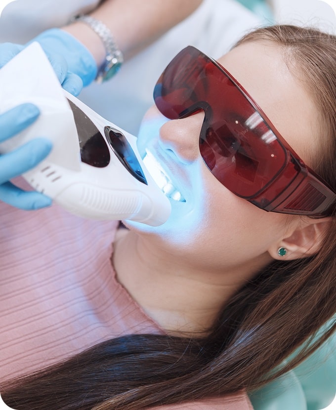 Teeth Whitening
